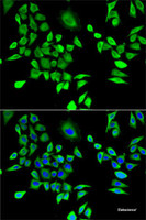 Immunofluorescence analysis of U2OS cells using HPRT1 Polyclonal Antibody