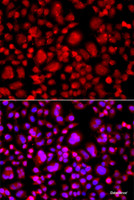 Immunofluorescence analysis of A549 cells using TP53BP2 Polyclonal Antibody