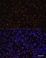 Immunofluorescence analysis of C6 cells using ZEB2 Polyclonal Antibody at dilution of 1:100. Blue: DAPI for nuclear staining.