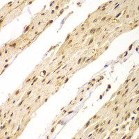 Immunohistochemistry of paraffin-embedded Human colon using CDX1 Polyclonal Antibody at dilution of 1:100 (40x lens) .
