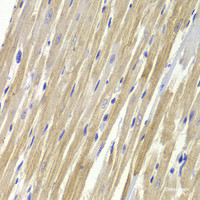 Immunohistochemistry of paraffin-embedded Rat heart using GPD1 Polyclonal Antibody at dilution of 1:100 (40x lens) .