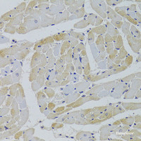 Immunohistochemistry of paraffin-embedded Rat heart using GPD1 Polyclonal Antibody at dilution of 1:100 (40x lens) .