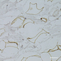 Immunohistochemistry of paraffin-embedded Human breast adipocytes using GPD1 Polyclonal Antibody at dilution of 1:100 (40x lens) .