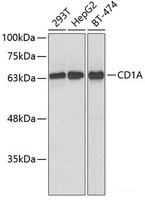 Western blot analysis of extracts of various cell lines using CD1A Polyclonal Antibody at dilution of 1:1000.