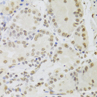 Immunohistochemistry of paraffin-embedded Human stomach using RUVBL1 Polyclonal Antibody at dilution of 1:100 (40x lens) .