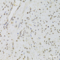 Immunohistochemistry of paraffin-embedded Human leiomyoma of uterus using RUVBL1 Polyclonal Antibody at dilution of 1:100 (40x lens) .