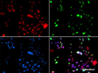 Immunofluorescence analysis of GFP-RNF168 transgenic U2OS cells using PIAS1 Polyclonal Antibody