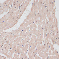 Immunohistochemistry of paraffin-embedded Rat heart using PRPF31 Polyclonal Antibody at dilution of 1:100 (40x lens) .