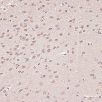 Immunohistochemistry of paraffin-embedded Mouse brain using PRPF31 Polyclonal Antibody at dilution of 1:100 (40x lens) .