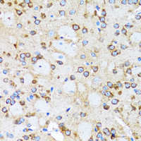 Immunohistochemistry of paraffin-embedded Rat brain using ACTR2 Polyclonal Antibody at dilution of 1:100 (40x lens) .