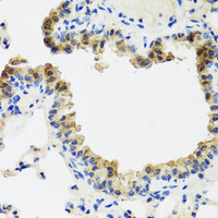 Immunohistochemistry of paraffin-embedded Mouse lung using ST6GAL1 Polyclonal Antibody at dilution of 1:100 (40x lens) .