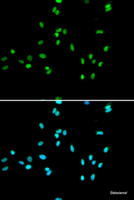 Immunofluorescence analysis of A549 cells using NR5A2 Polyclonal Antibody