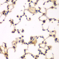 Immunohistochemistry of paraffin-embedded Rat lung using NFKBIB Polyclonal Antibody at dilution of 1:200 (40x lens) .
