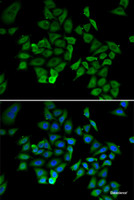 Immunofluorescence analysis of U2OS cells using NFKBIB Polyclonal Antibody