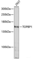 Western blot analysis of extracts of 293T cells using TOPBP1 Polyclonal Antibody at dilution of 1:1000.