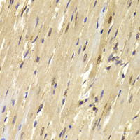 Immunohistochemistry of paraffin-embedded Mouse heart using TOPBP1 Polyclonal Antibody at dilution of 1:100 (40x lens) .