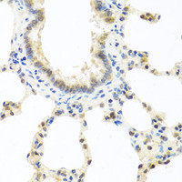 Immunohistochemistry of paraffin-embedded Rat lung using DEDD Polyclonal Antibody at dilution of 1:100 (40x lens) .