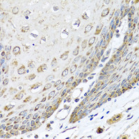 Immunohistochemistry of paraffin-embedded Human esophagus using DEDD Polyclonal Antibody at dilution of 1:100 (40x lens) .