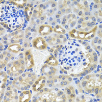 Immunohistochemistry of paraffin-embedded Mouse kidney using DEDD Polyclonal Antibody at dilution of 1:100 (40x lens) .