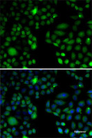 Immunofluorescence analysis of U2OS cells using EPC1 Polyclonal Antibody