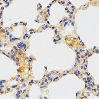 Immunohistochemistry of paraffin-embedded Mouse lung using ATG3 Polyclonal Antibody at dilution of 1:200 (40x lens) .