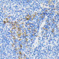 Immunohistochemistry of paraffin-embedded Mouse spleen using ATG3 Polyclonal Antibody at dilution of 1:200 (40x lens) .