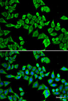 Immunofluorescence analysis of HeLa cells using DDX20 Polyclonal Antibody