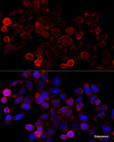 Immunofluorescence analysis of HeLa cells using KAT7 Polyclonal Antibody at dilution of 1:100 (40x lens) . Blue: DAPI for nuclear staining.