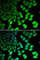 Immunofluorescence analysis of U2OS cells using KDM4B Polyclonal Antibody