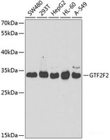 Western blot analysis of extracts of various cell lines using GTF2F2 Polyclonal Antibody at dilution of 1:1000.