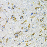 Immunohistochemistry of paraffin-embedded Mouse brain using PDYN Polyclonal Antibody at dilution of 1:100 (40x lens) .