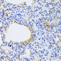 Immunohistochemistry of paraffin-embedded Rat lung using MRPS30 Polyclonal Antibody at dilution of 1:100 (40x lens) .