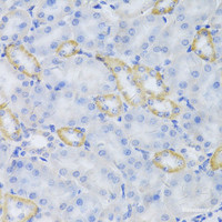 Immunohistochemistry of paraffin-embedded Mouse kidney using MRPS30 Polyclonal Antibody at dilution of 1:100 (40x lens) .