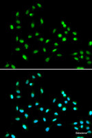 Immunofluorescence analysis of A549 cells using SMARCAD1 Polyclonal Antibody