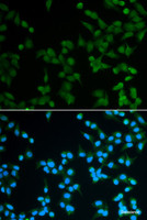 Immunofluorescence analysis of A549 cells using SPIN1 Polyclonal Antibody