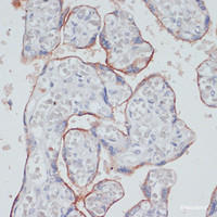 Immunohistochemistry of paraffin-embedded Human placenta using TFRC Polyclonal Antibody at dilution of 1:100 (40x lens) .