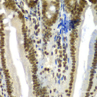 Immunohistochemistry of paraffin-embedded Mouse Intestine using SF3B2 Polyclonal Antibody at dilution of 1:100 (40x lens) .