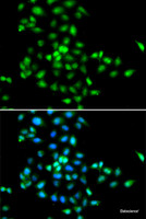 Immunofluorescence analysis of MCF-7 cells using SBDS Polyclonal Antibody