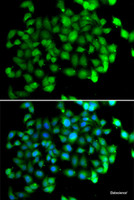 Immunofluorescence analysis of U2OS cells using APOBEC3C Polyclonal Antibody