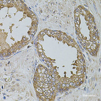 Immunohistochemistry of paraffin-embedded Human prostate using KTN1 Polyclonal Antibody at dilution of 1:100 (40x lens) .