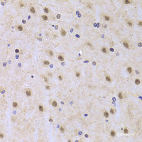 Immunohistochemistry of paraffin-embedded Rat brain using ILF2 Polyclonal Antibody at dilution of 1:100 (40x lens) .