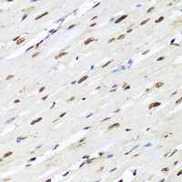 Immunohistochemistry of paraffin-embedded Rat heart using HNRNPR Polyclonal Antibody at dilution of 1:100 (40x lens) .