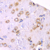 Immunohistochemistry of paraffin-embedded Rat brain using RPS3A Polyclonal Antibody at dilution of 1:100 (40x lens) .