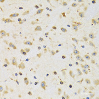 Immunohistochemistry of paraffin-embedded Rat brain using RPS12 Polyclonal Antibody at dilution of 1:100 (40x lens) .