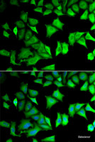 Immunofluorescence analysis of MCF-7 cells using RPS12 Polyclonal Antibody
