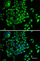 Immunofluorescence analysis of U2OS cells using MRPL28 Polyclonal Antibody