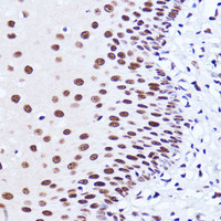 Immunohistochemistry of paraffin-embedded Human esophageal using MATR3 Polyclonal Antibody at dilution of 1:100 (40x lens) .