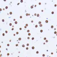 Immunohistochemistry of paraffin-embedded Mouse brain using MATR3 Polyclonal Antibody at dilution of 1:100 (40x lens) .