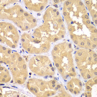 Immunohistochemistry of paraffin-embedded Human kidney using TRIM69 Polyclonal Antibody at dilution of 1:100 (40x lens) .