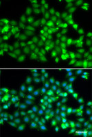 Immunofluorescence analysis of A549 cells using TRIM69 Polyclonal Antibody